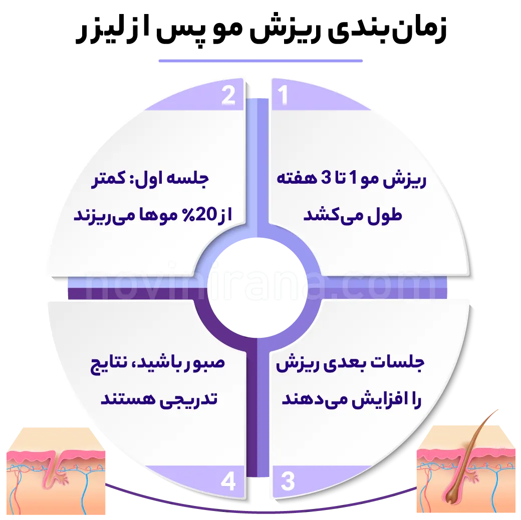 چند روز بعد از اولین جلسه لیزر موها می ریزد
